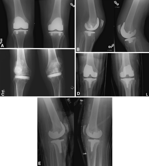 Fig. 1A–E