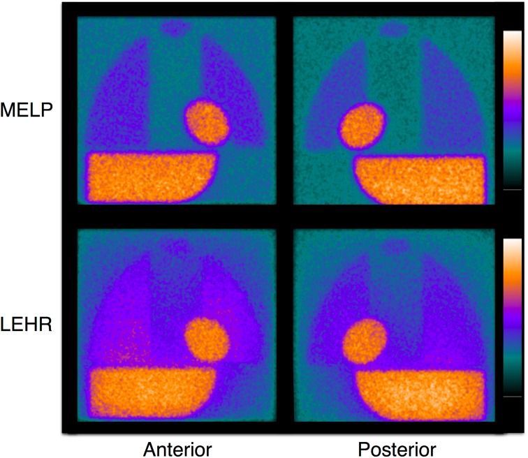 Fig. 2