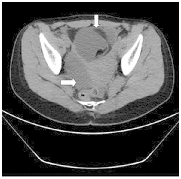 Figure 2.