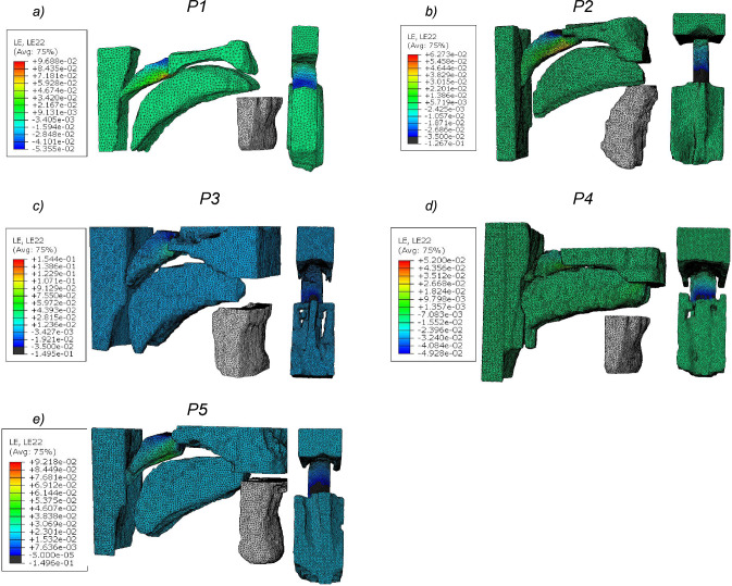 Fig. 11