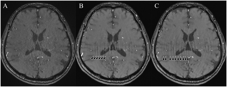 Fig 5