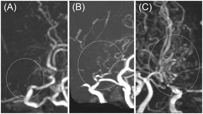 Fig 3