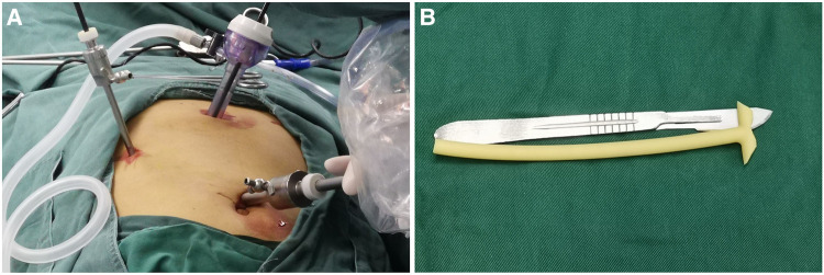 An Alternative Palliative Surgical Method For Advanced Malignant 