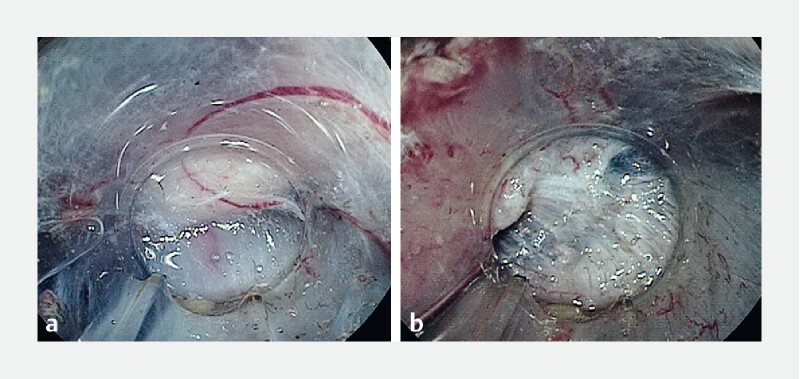 Fig. 3 a