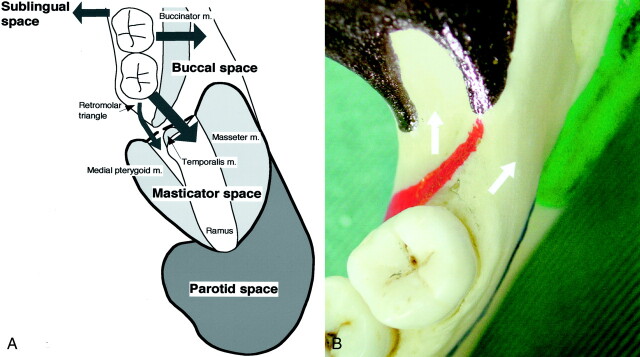 Fig 4.