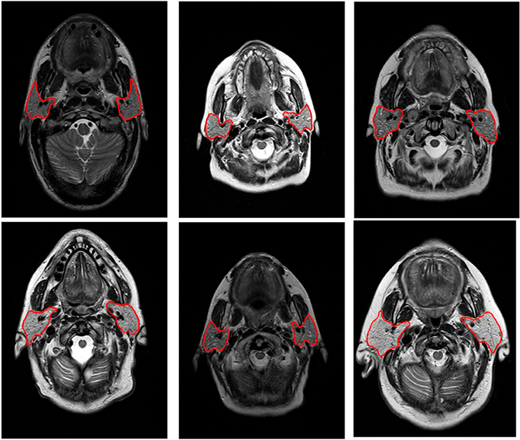 FIGURE 6.