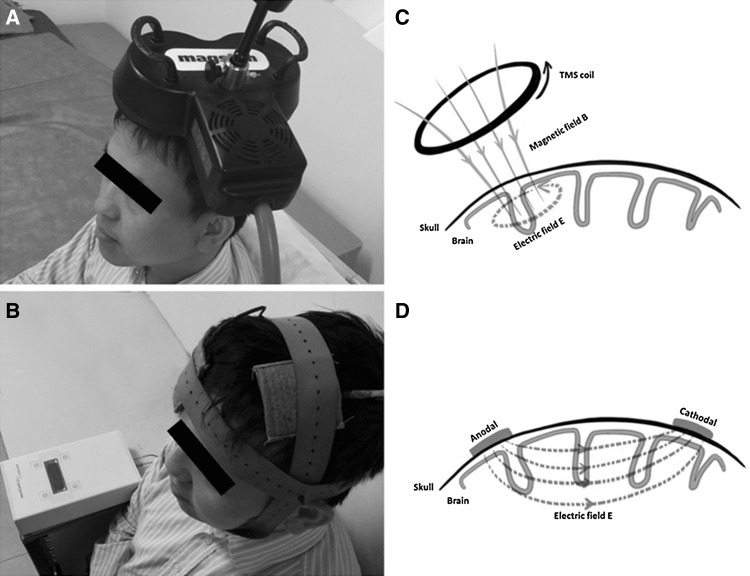 Fig. 1