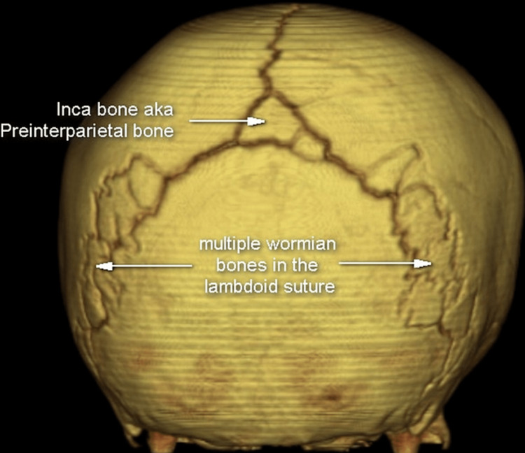 Figure 14