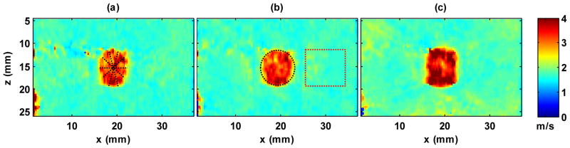 Fig. 11