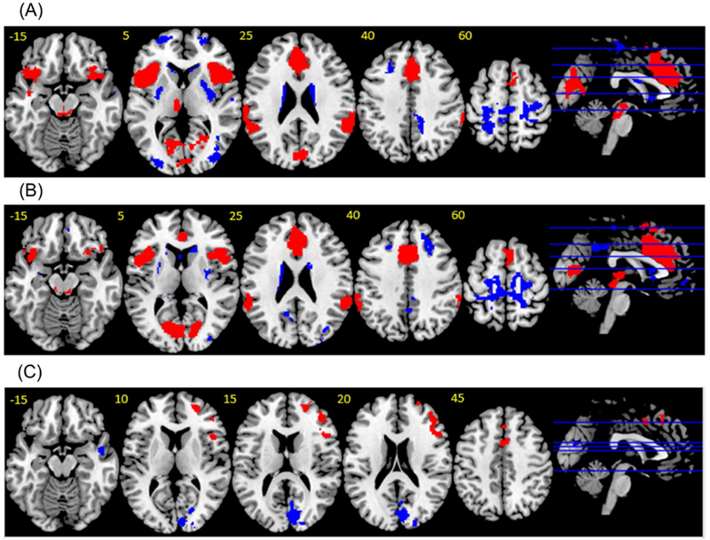 Error-processing and inhibitory control in obsessive-compulsive ...