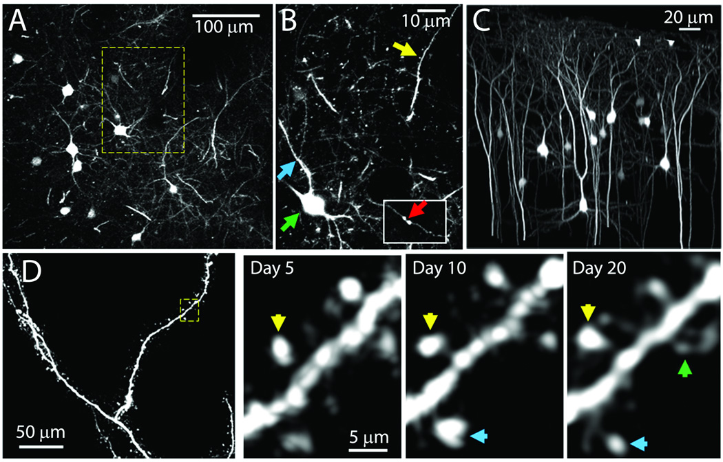 Figure 11