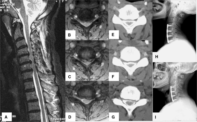 Fig. 1