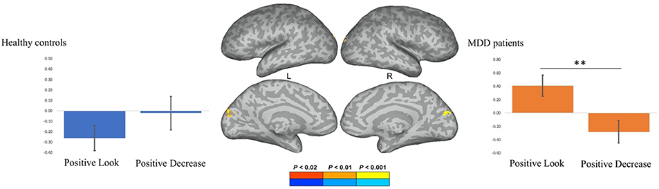 Fig. 11