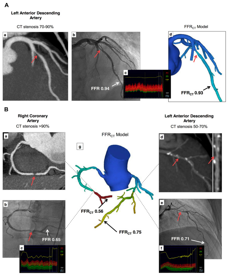 Figure 24