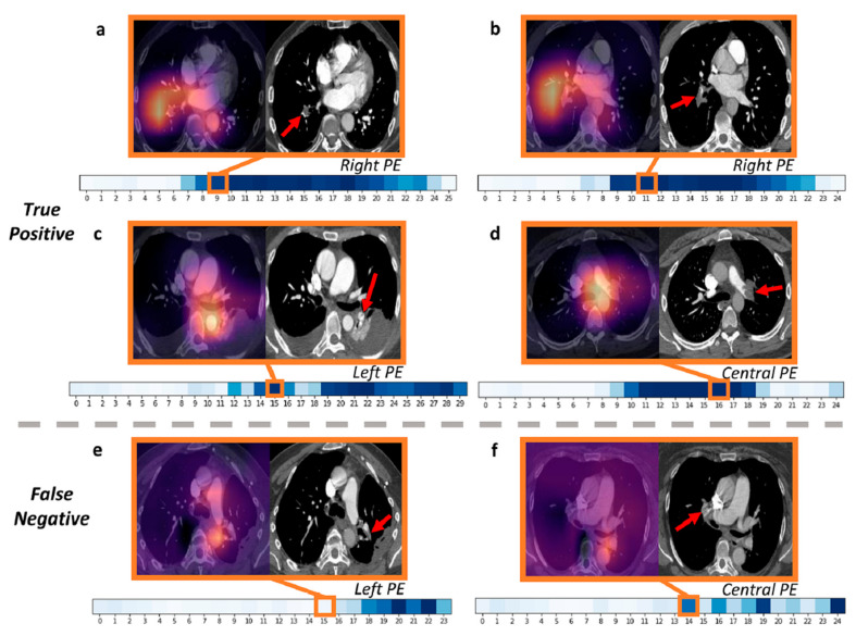 Figure 31