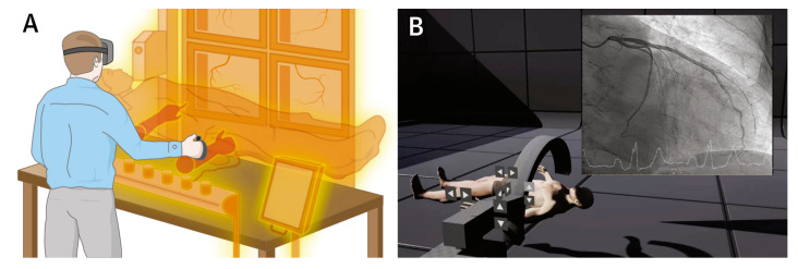 Figure 25