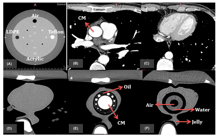 Figure 17