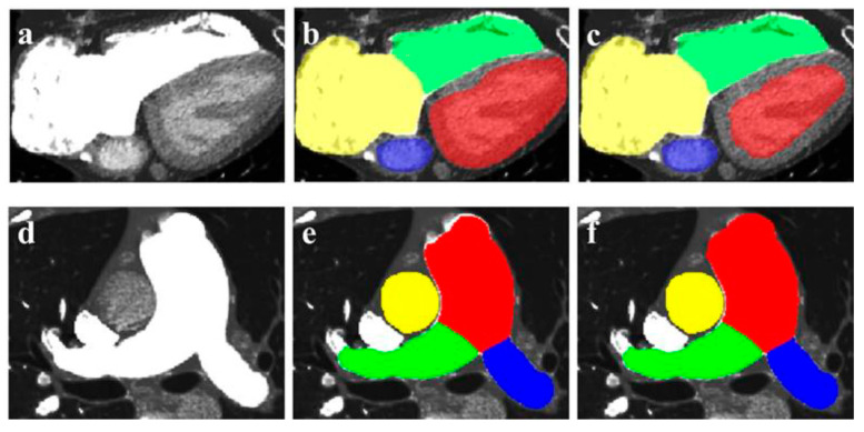 Figure 32