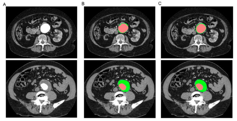 Figure 30