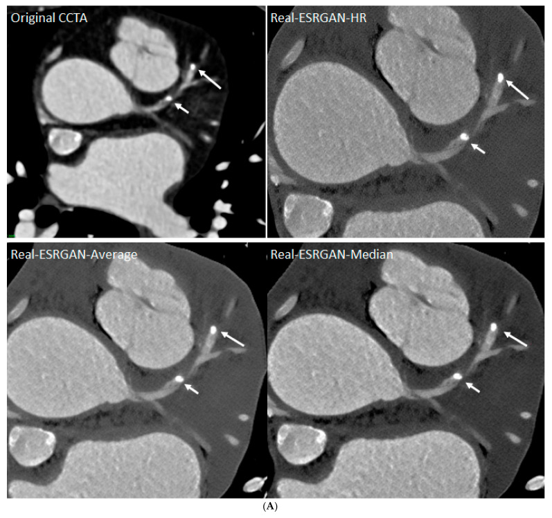 Figure 28