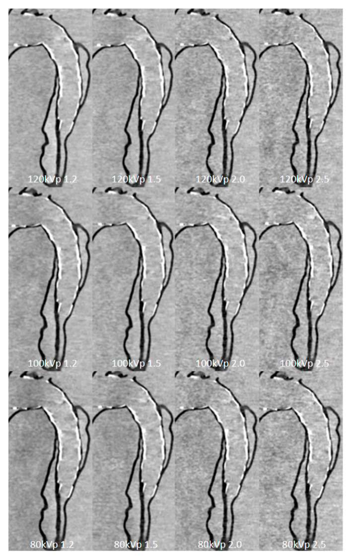 Figure 19