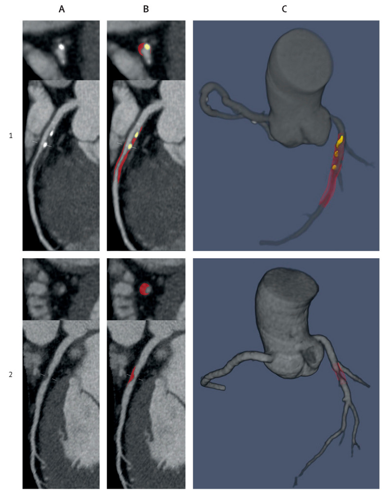 Figure 29