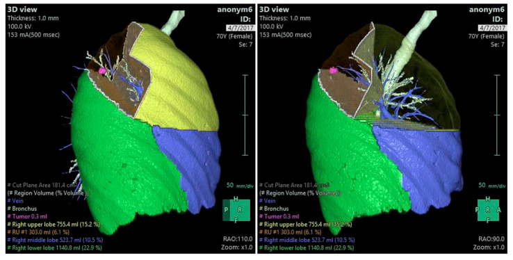 Figure 27