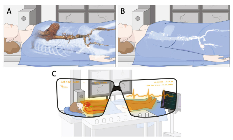 Figure 26