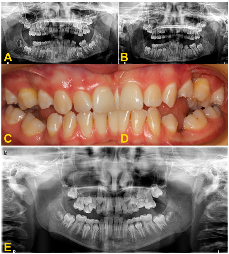 Figure 10