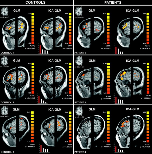 Fig 3.