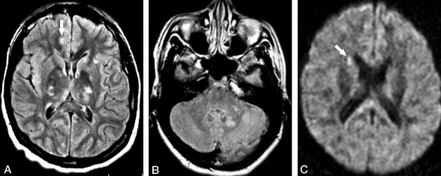 Fig 3.