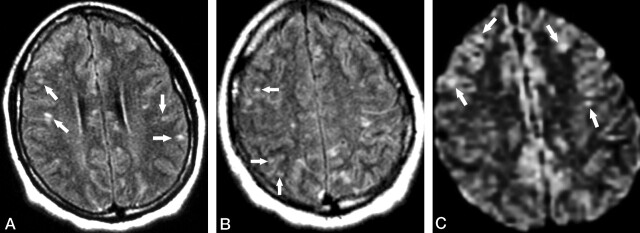 Fig 2.