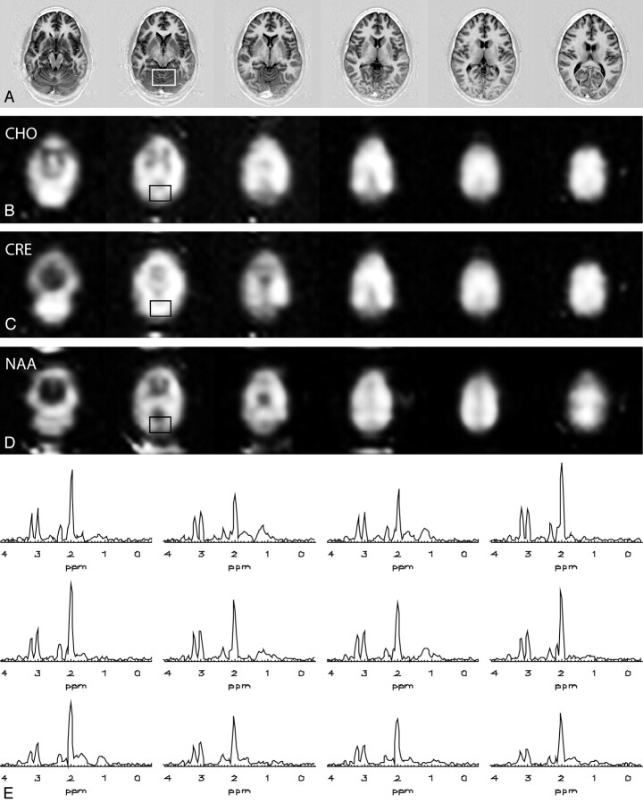 Fig 3.