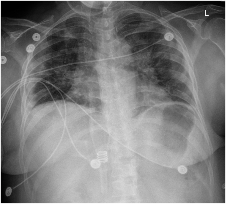 Fig. 5