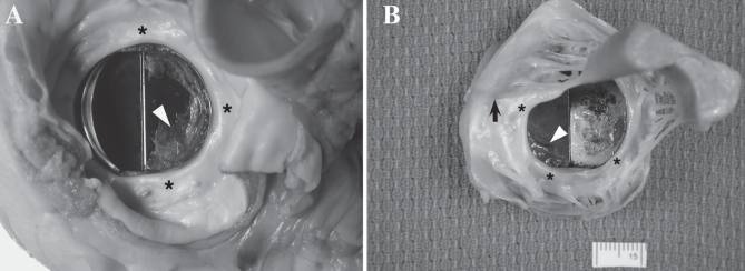 Figure 2)