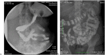 Fig 8
