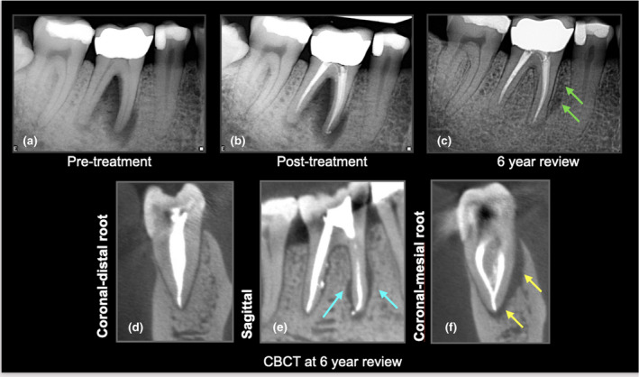 FIGURE 4