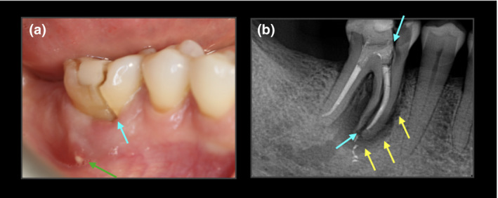 FIGURE 1