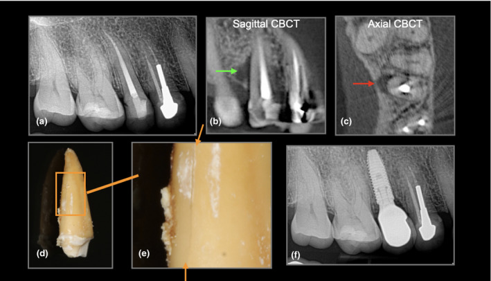 FIGURE 3