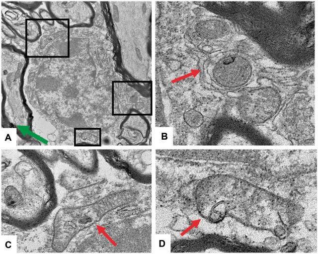 FIGURE 3.