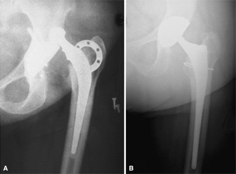 Fig. 4A–B