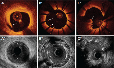 Figure 4: