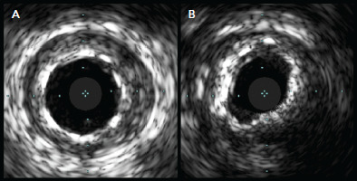 Figure 3: