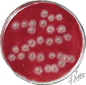Figure 33-7