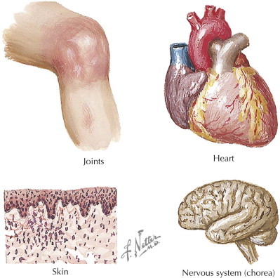 Figure 33-5