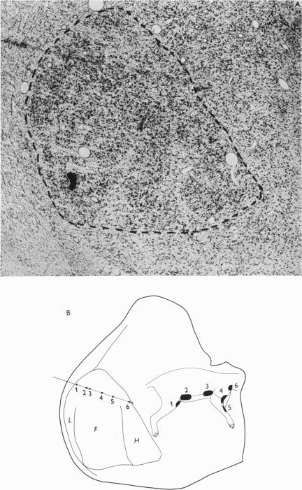 Fig. 12