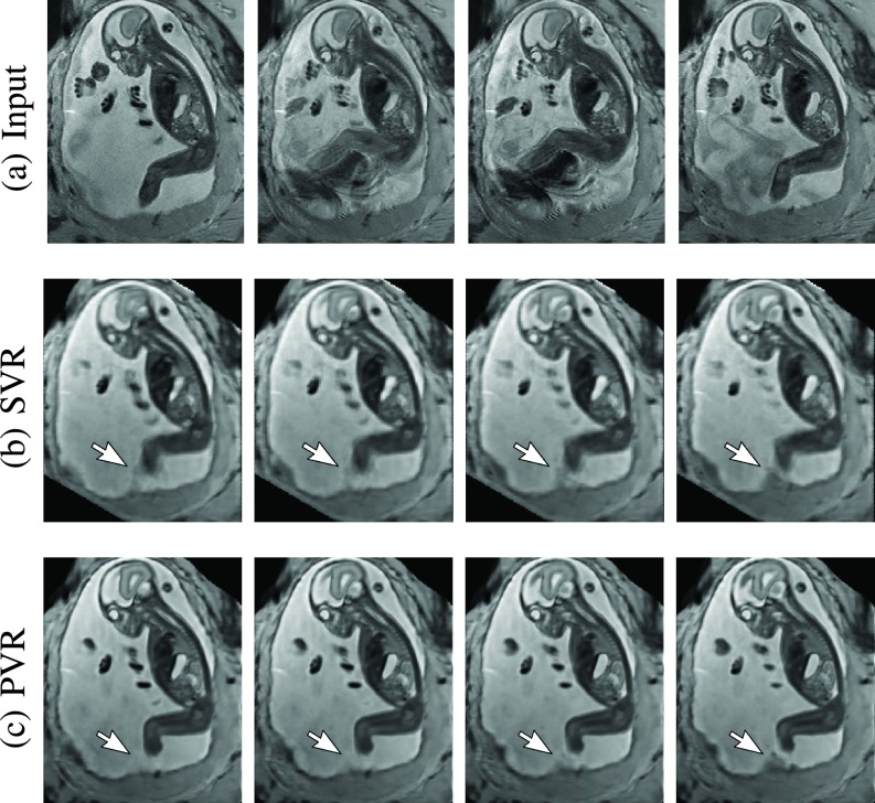Fig. 10.