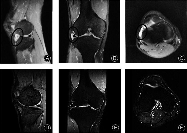 FIG. 6