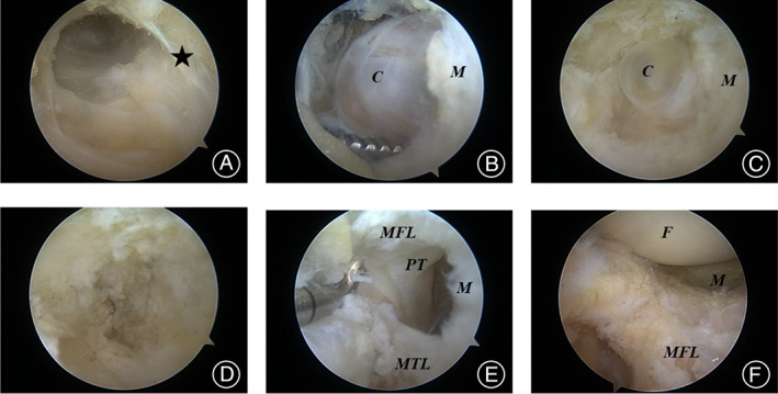 FIG. 3