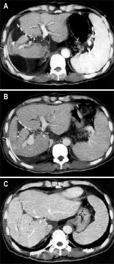 Fig. 14